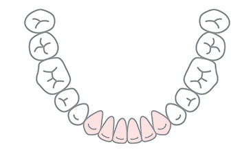 部位別のセラミック　前歯
