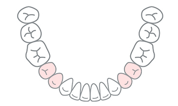 部位別のセラミック　小臼歯