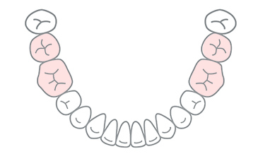 部位別のセラミック　大臼歯