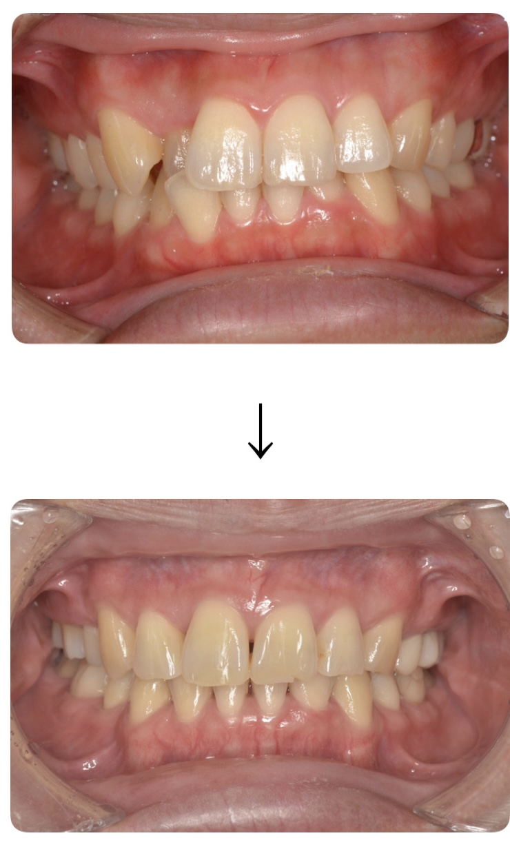 【裁断済み】治る歯槽治らない歯槽 ハイライトQ&A91 裁断済み】治る歯槽治らない歯槽 ハイライトQ&A91 - メルカリ